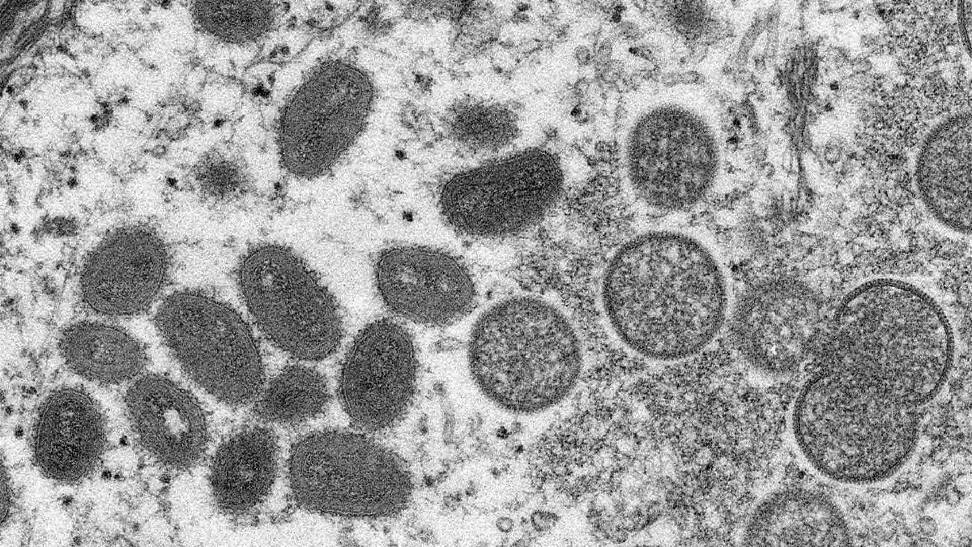 Monkeypox Virion CDC 1920x1080