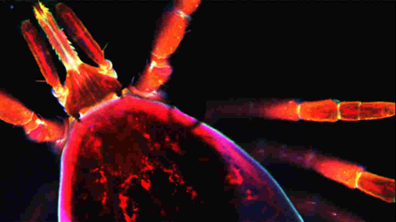 Fluro Tick 1920x1080 Thumbnail