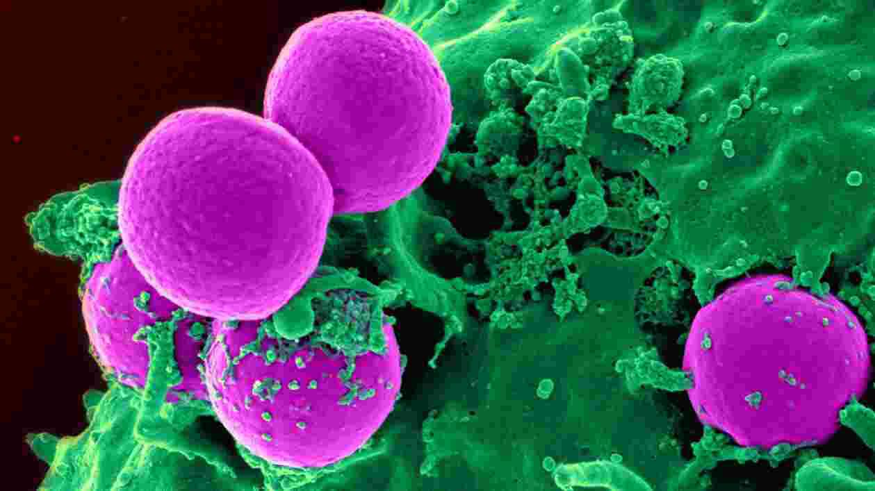 Human neutrophil ingesting MRSA 1920x1080 Thumbnail