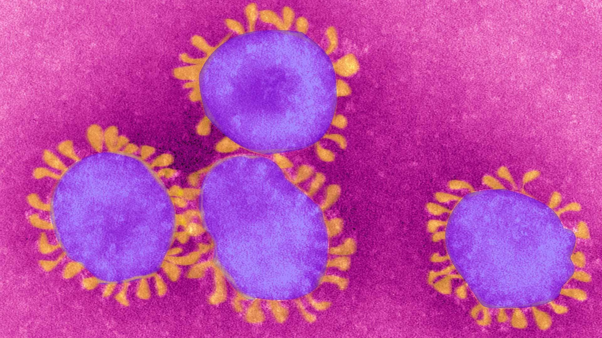 Pink and purple image of coronavirus