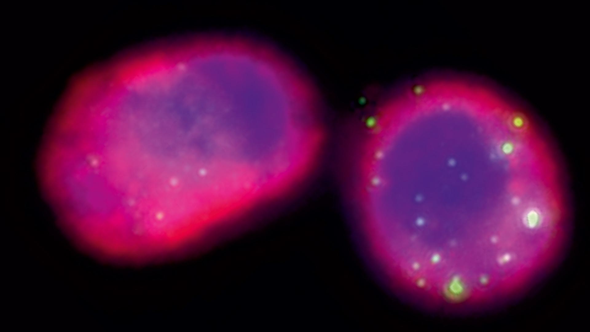 Two pink bacteriophages, a type of virus, against a black background
