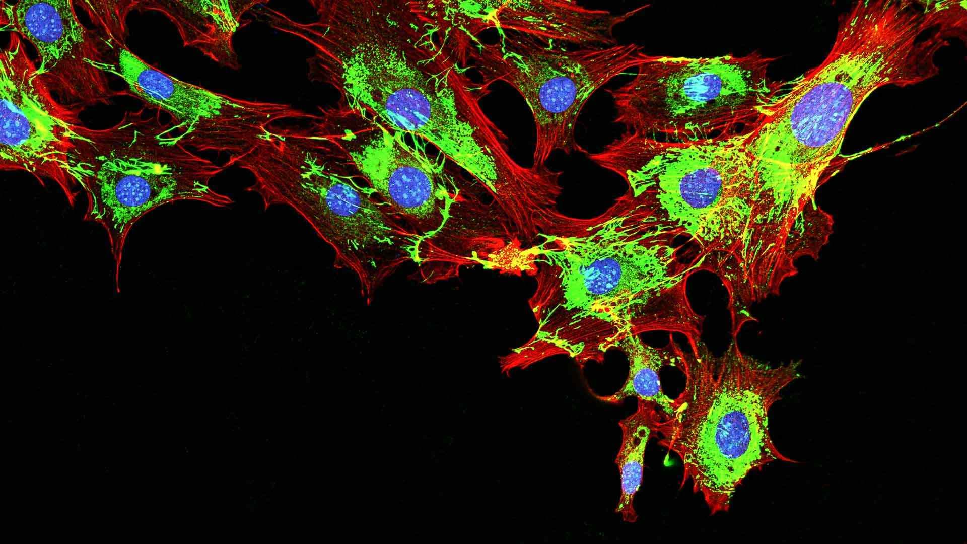 Imaging of metastatic cancer cells spreading on the surrounding tissue