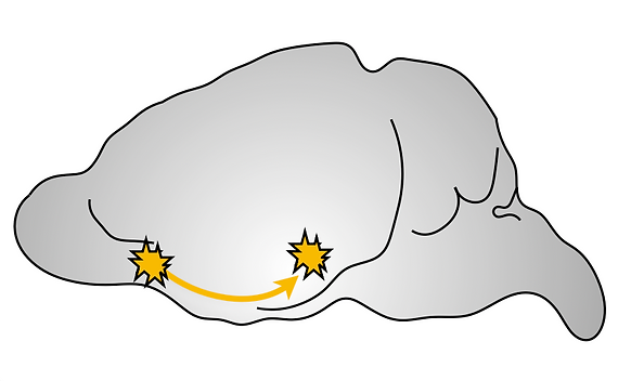 Diagram depicting the connection between the orbitofrontal cortex and the auditory cortex in the brain.