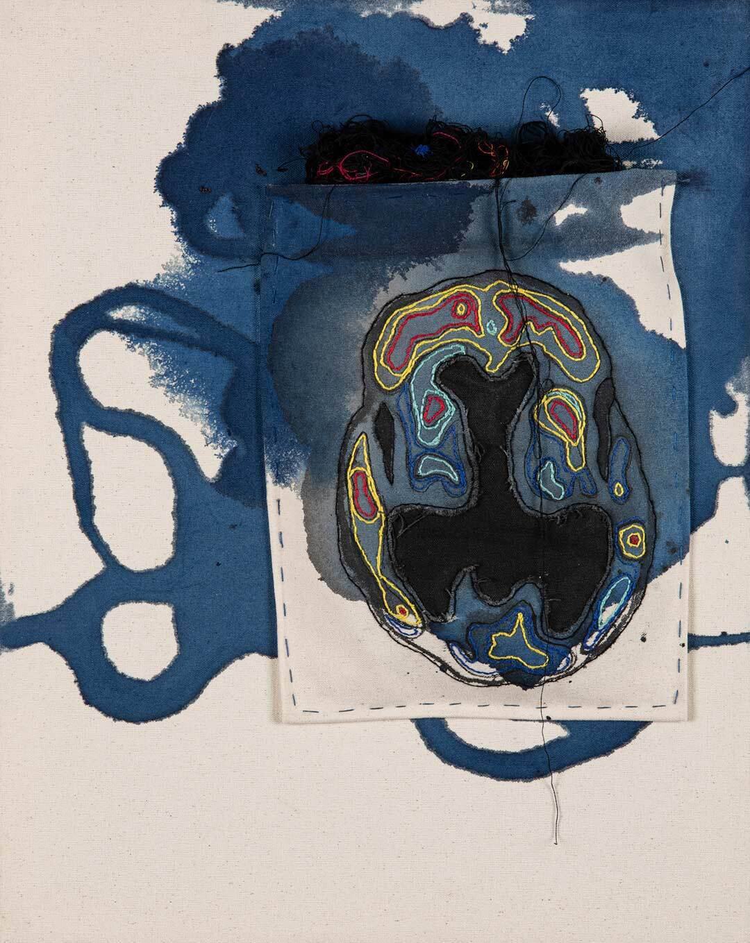 Dementia stain darkness visible web
