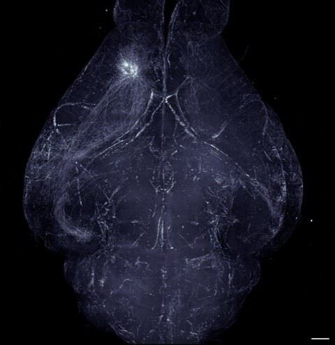 brain scan image